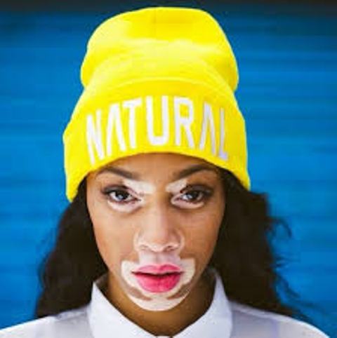 ‘Unconventional Beauty’- Chantelle Brown-Young
